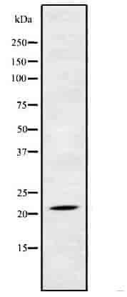 NDUFB5 Antibody
